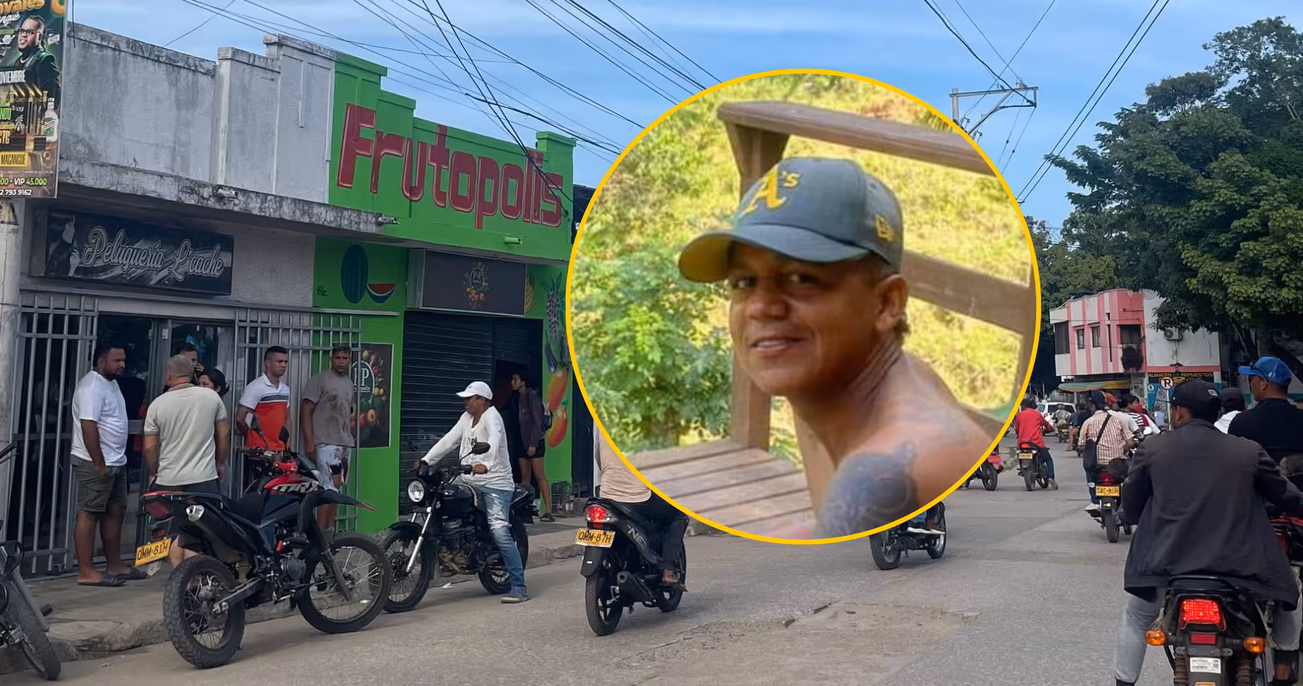 Hombre de 28 años fue baleado en local comercial de Magangué