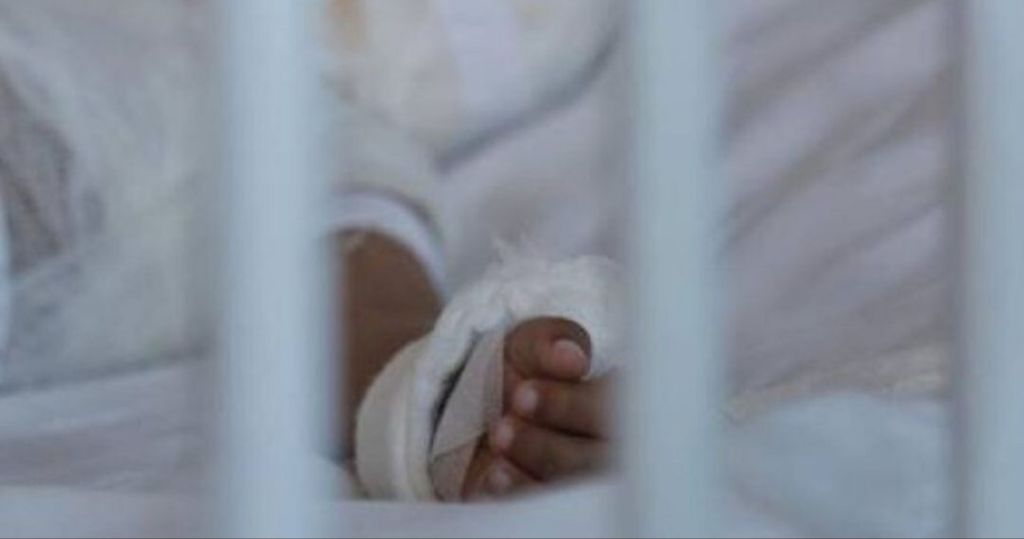Niño de nueve meses sufre quemaduras tras caída de café caliente en Bolívar